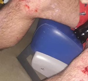 Ataque homofóbico en Villa Urquiza